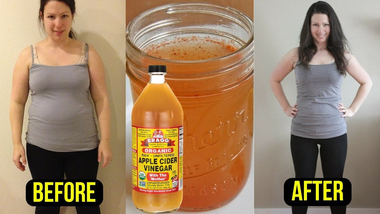 Apple Cider Vinegar To Lose Weight
 Take 1 Tablespoon of Apple Cider Vinegar & Burn Belly Fat
