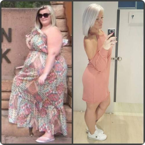 Before And After Keto Diet
 Pin on Ketogenic Diet